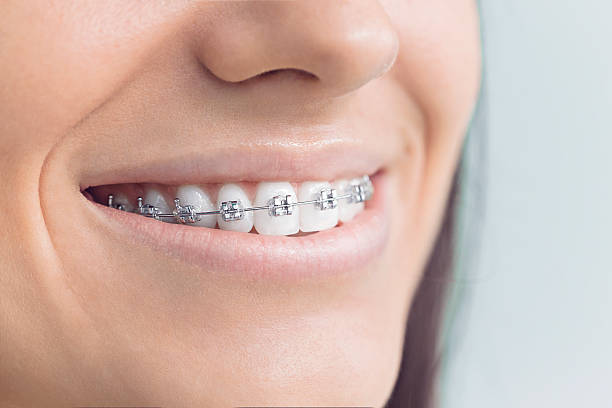 Why Choose Us for Your Dental Needs in Bannockburn, IL